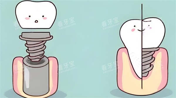 ������ֲ��ͨͼƬ