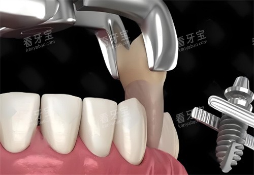 ��������չʾͼƬ