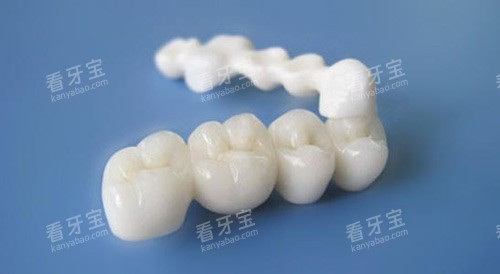 全瓷牙半口展示图 全瓷牙半口展示图