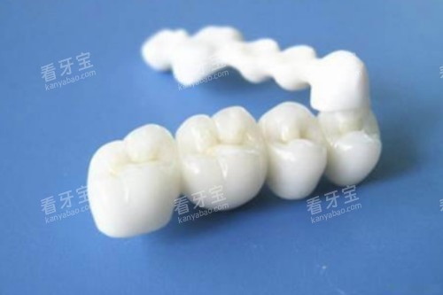 全瓷牙冠模型一览图 全瓷牙冠模型一览图