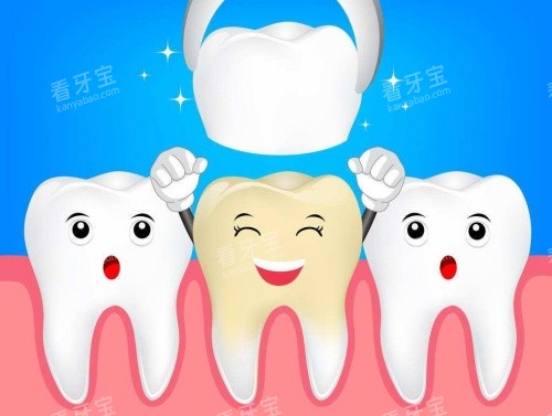 烤瓷牙义齿修复示意图 烤瓷牙义齿修复示意图