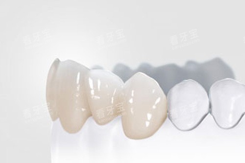 ȫ������ģ��ͼ