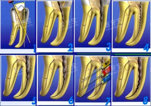 �������Ʋ���ͼϸ��