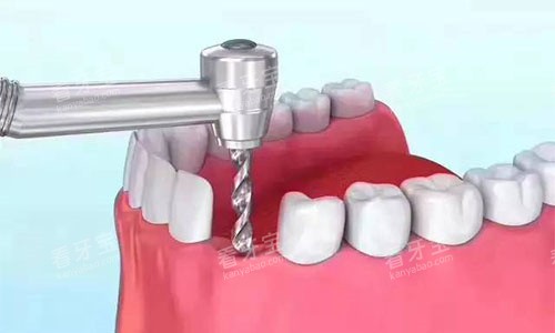 ��ֲ��׼����ֲ��