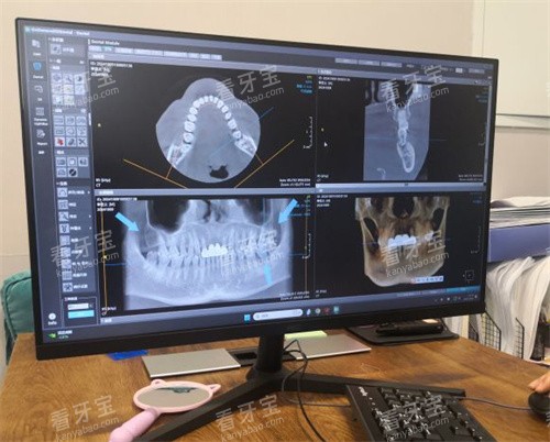 北京牙元素口腔牙齿拍片室 北京牙元素口腔牙齿拍片室