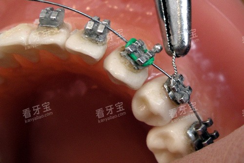 ���ݽ�������װʾ��ͼ