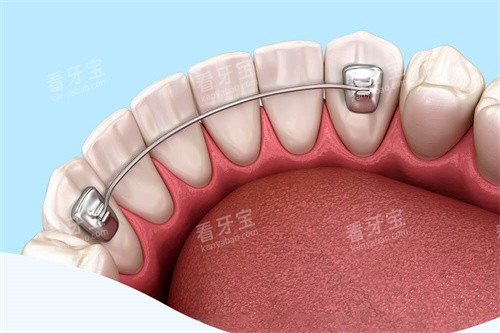 ��ౣ����