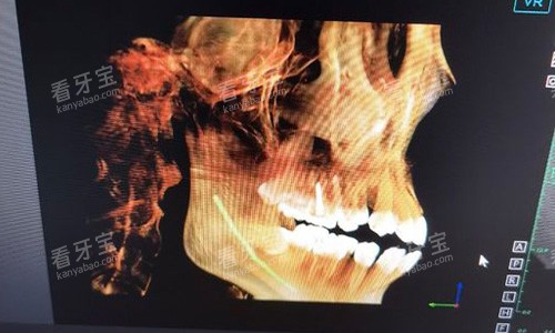 �𻪶�����ˬ��ǻ������Ƭʾ��ͼ