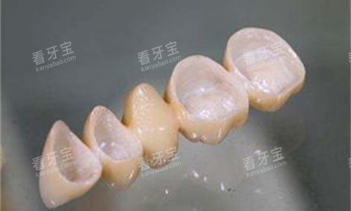 全瓷牙内冠展示图 全瓷牙内冠展示图