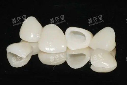 全瓷牙冠实物示意图 全瓷牙冠实物示意图