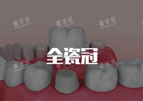 全瓷牙冠修复改善 全瓷牙冠修复改善
