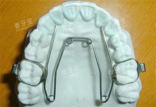 四眼簧扩弓器模型 四眼簧扩弓器模型