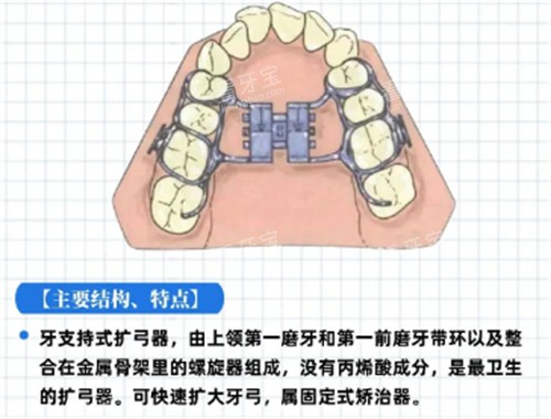 Hyrax扩弓器特点 Hyrax扩弓器特点