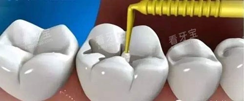 �������ƹ���ʾ��ͼ