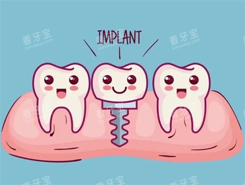 种植牙漫画示意图 种植牙漫画示意图