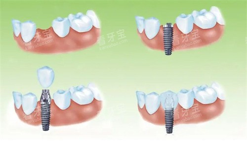 ��ֲ������