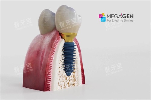 ������������ֲ��ֲ��ͼ