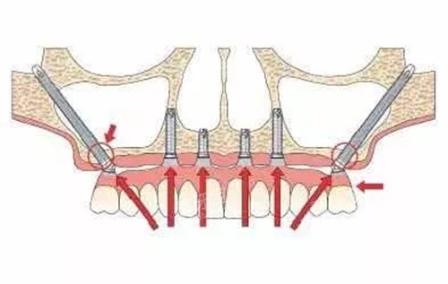 ��ȧ������ֲ