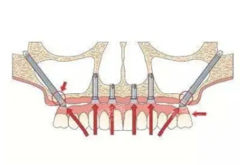 ��ȧ������ֲ��ͨͼƬչʾ