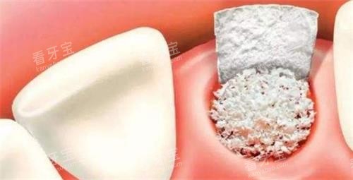 ���ƹǷ�ʾ��ͼ