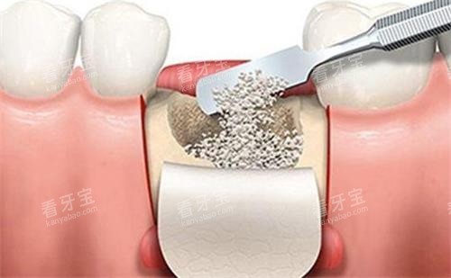 ���ƹǷ���;