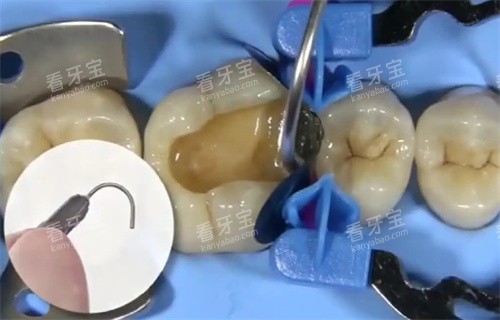 ȣ��������