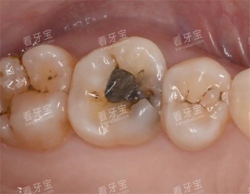 ����ȣ����Ƭ