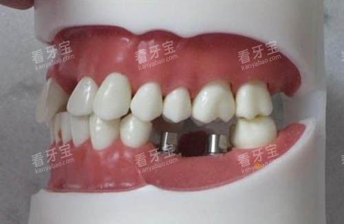 ��Ҫ�������������ͼ