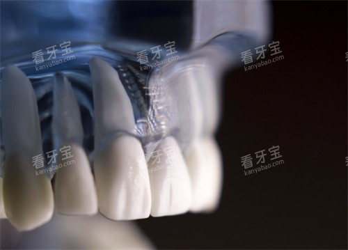 ��������ͼʾ