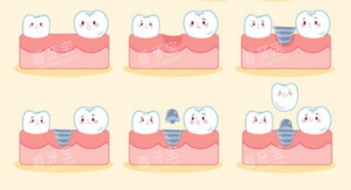 ��������ʾ��ͼ