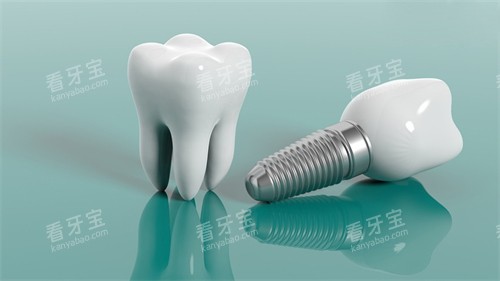 种植牙植体和牙冠漫画示意图 种植牙植体和牙冠漫画示意图