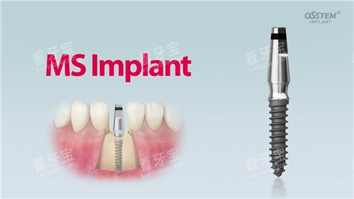 �³�̩��ֲ��