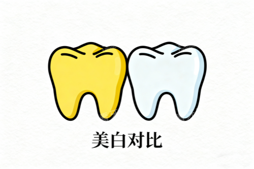牙齿美白前后对比展示图 牙齿美白前后对比展示图