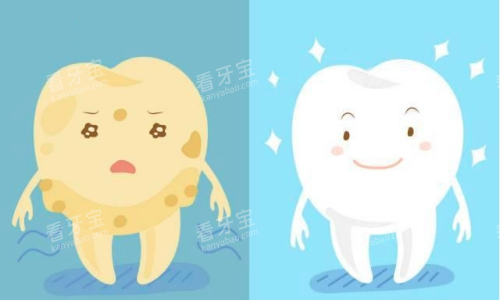 牙齿美白前后对比图 牙齿美白前后对比图