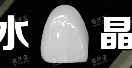 水晶瓷贴面 水晶瓷贴面