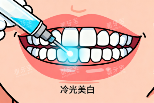 牙齿冷光美白卡通图 牙齿冷光美白卡通图