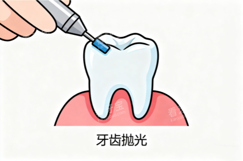 牙齿抛光卡通图 牙齿抛光卡通图
