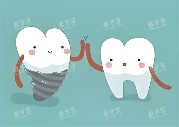 牙齿种植卡通图展示 牙齿种植卡通图展示