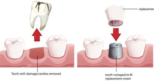 ��ֲ�������ʹ���ͼ