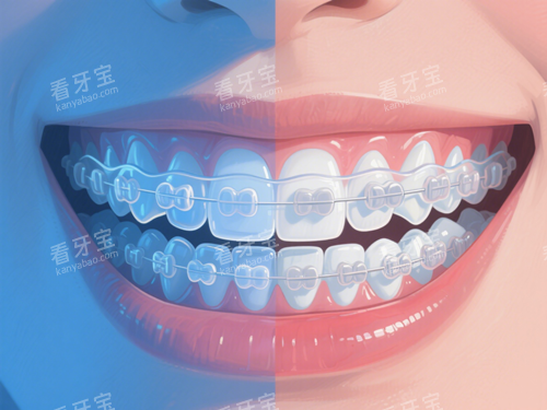 �մ����׽���