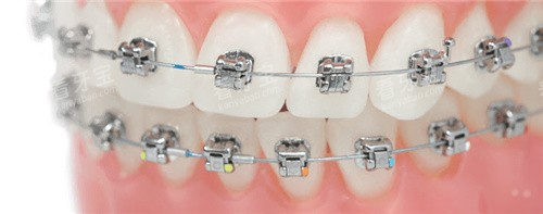 �����в۽�����ģ��