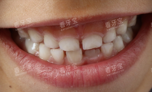 ���ݲ���