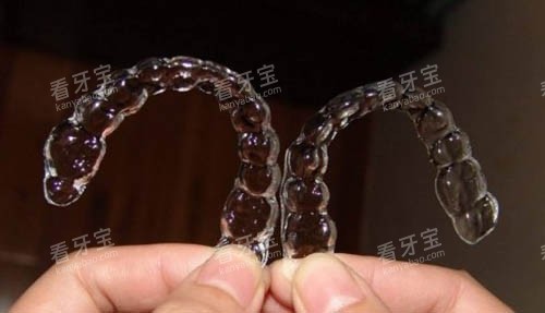 一组隐形牙套照片 一组隐形牙套照片