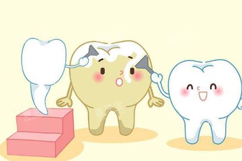 牙齿美学修复卡通示意图 牙齿美学修复卡通示意图