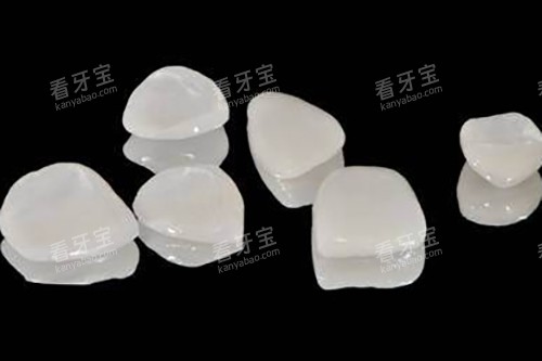 全瓷贴面实物展示图 全瓷贴面实物展示图