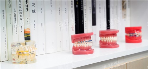 牙套模型图展示 牙套模型图展示