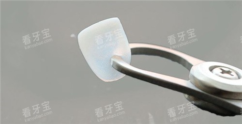 超薄牙齿贴面 超薄牙齿贴面