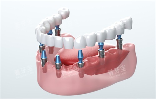 �����ֲ��ʾ��ͼ