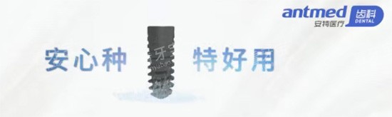 安特种植牙好不好 安特种植牙好不好