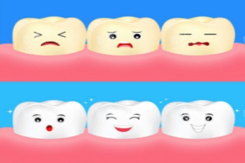 牙齿美白卡通展示 牙齿美白卡通展示